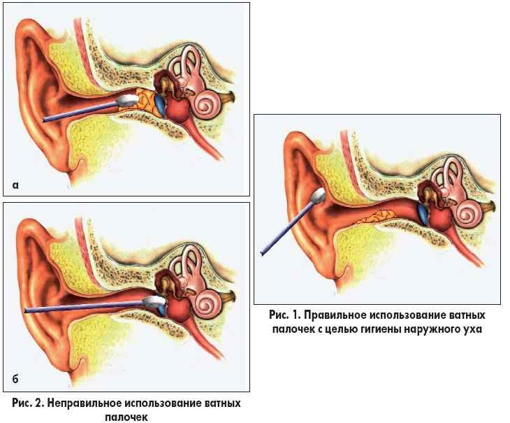 Image 22